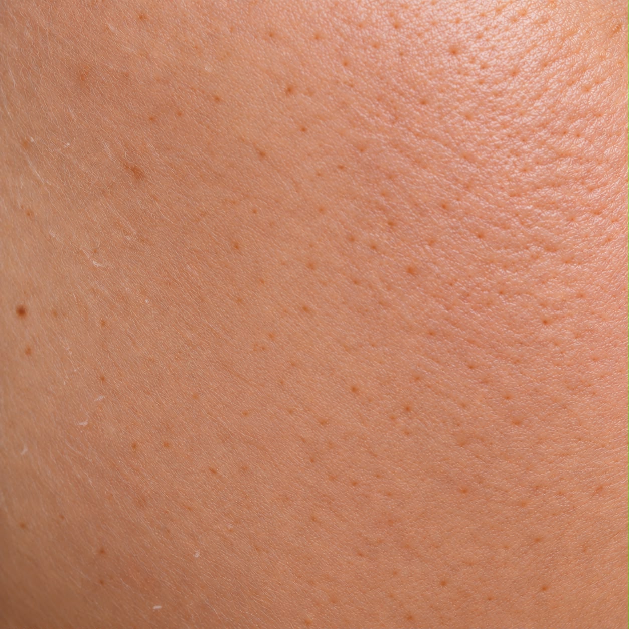 Combination skin